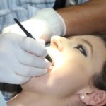 Tipos de Implantes Dentales en Huelva: Recupera Tu Sonrisa de Manera Personalizada